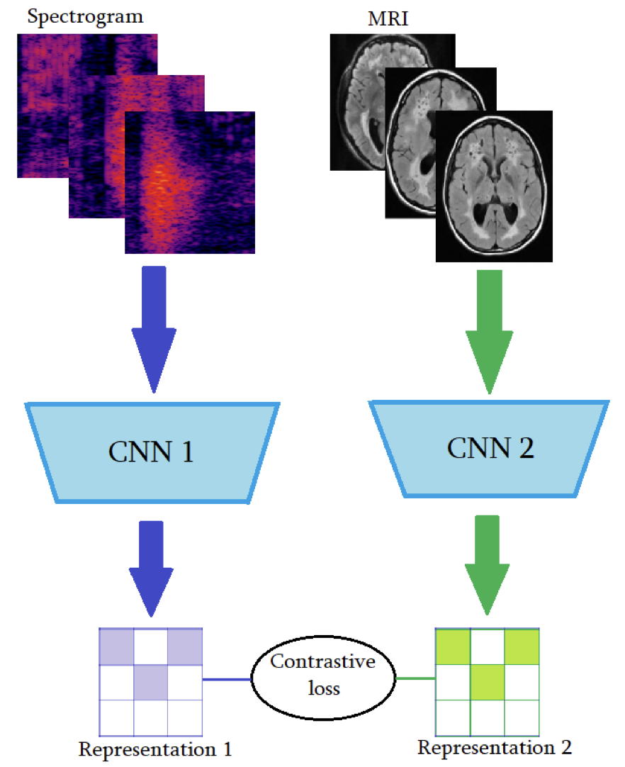 MRI-EEG Instance Discrimination for Brain Lesion Identification